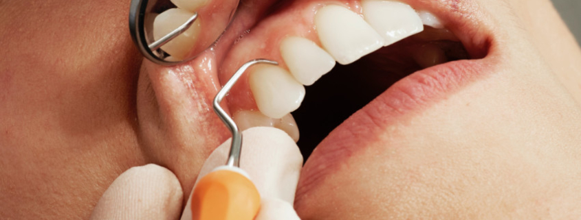 Blog 6 causas de dolor dental