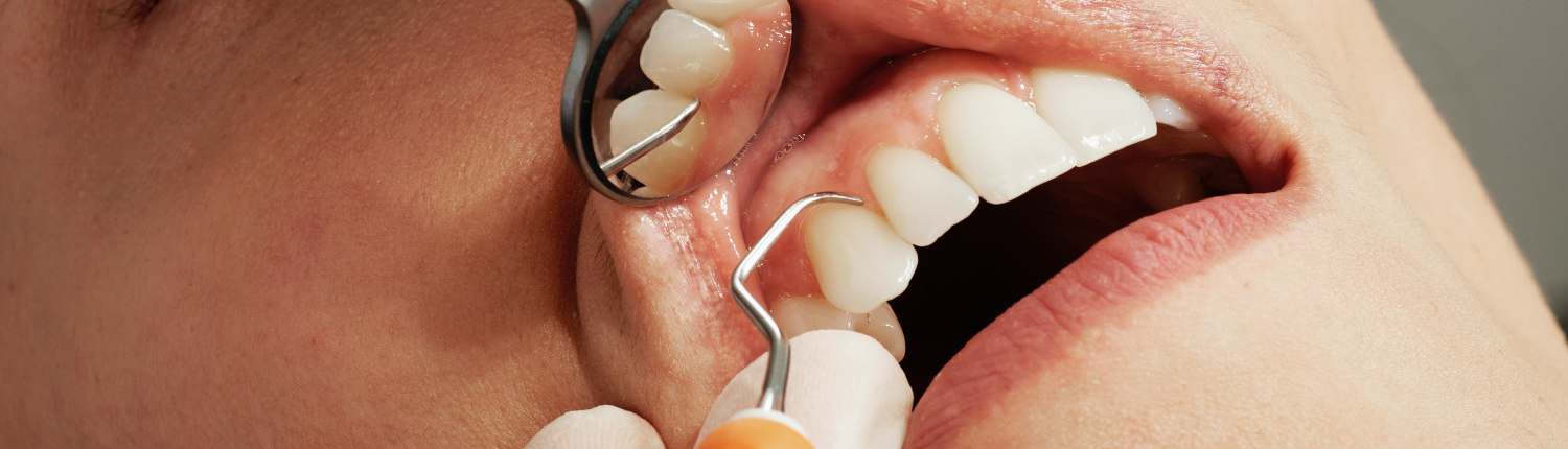 Blog 6 causas de dolor dental